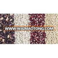 Dry Pinto Beans or Light Speckled Kidney Beans(Long Shape) Size 220-240 PCS